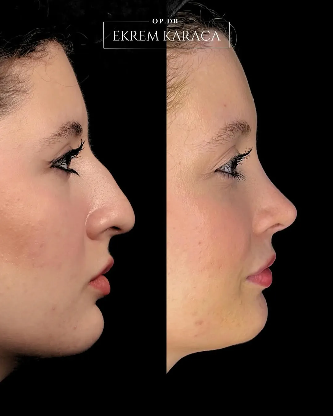 drekremkaraca customer gallery 44 cdn