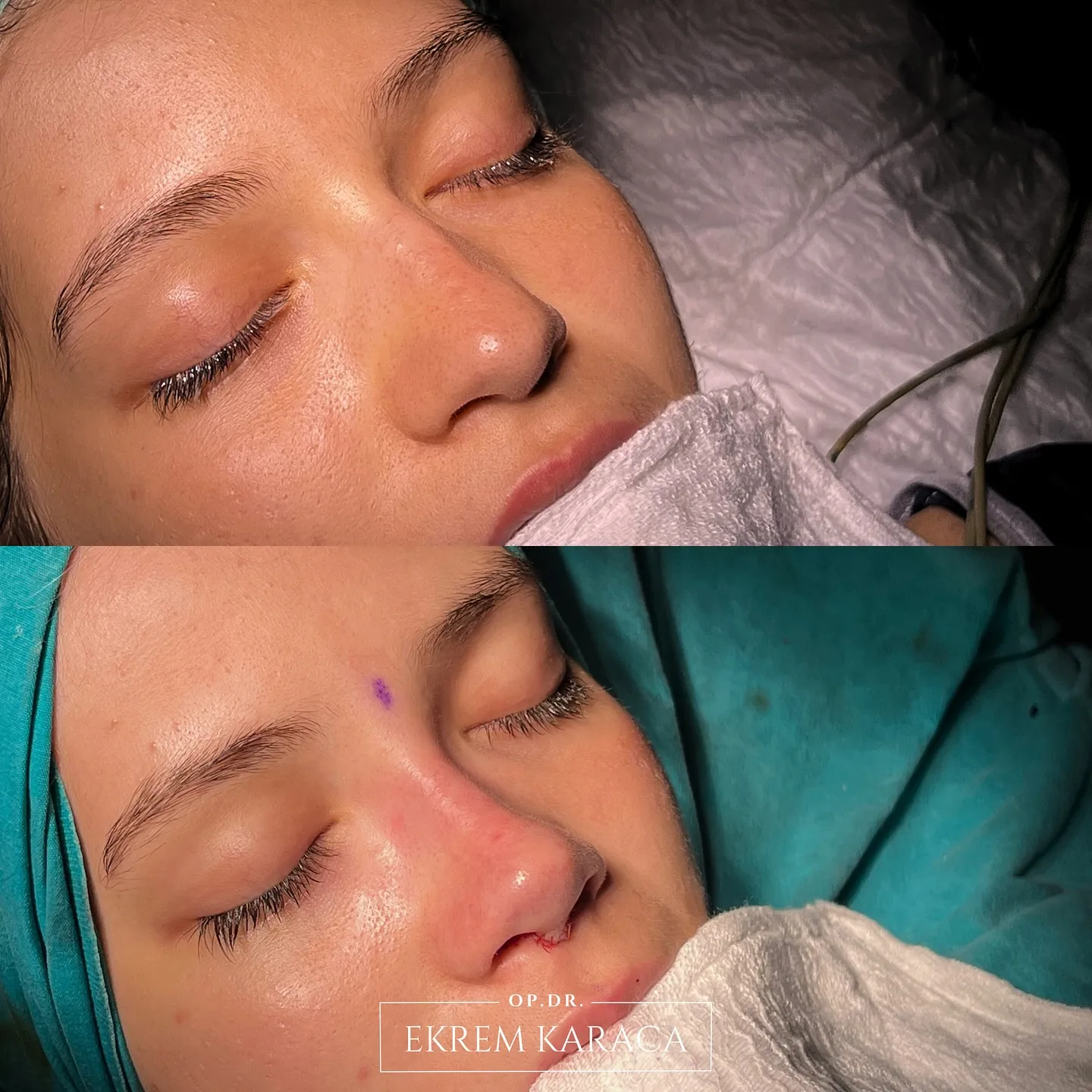 drekremkaraca customer gallery 49 cdn